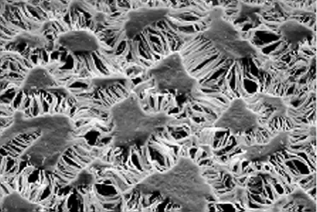 Membrana de PTFE expandido vista al microscopio electrónico, con una red de islotes de unos 10 micrómetros unidos por fibrillas