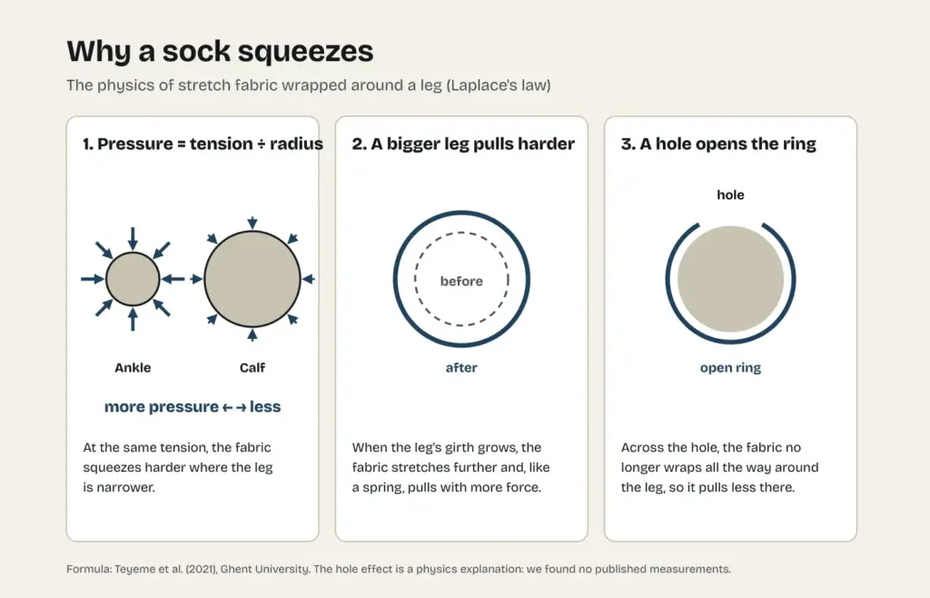 Diagram of Laplace's law applied to a sock: pressure is tension divided by radius, a bigger leg stretches the fabric more, and a hole opens the ring of tension